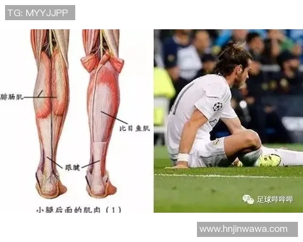 腓肠肌在足球运动中的重要性与训练方法探讨